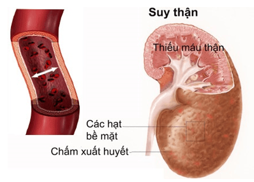 Nghiên cứu tham khảo về tia hồng ngoại xa